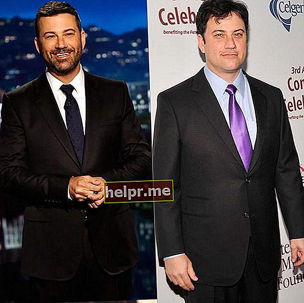 Jimmy Kimmel prieš ir po