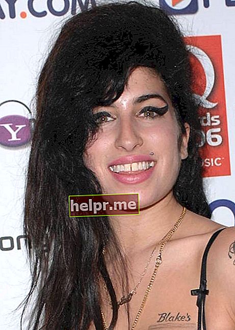 Amy Winehouse diente abierto